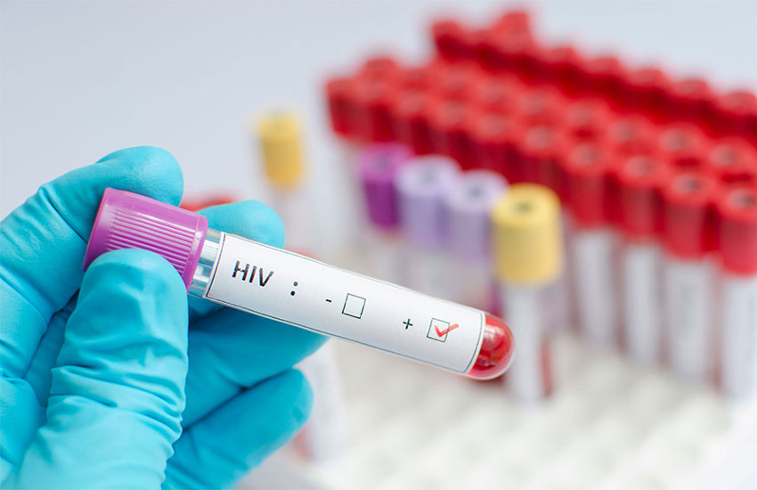 Detección temprana del VIH